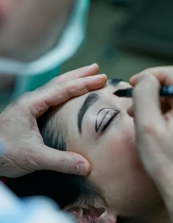 Blefaroplastia-Superior