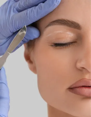 Blefaroplastia