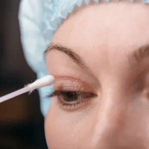 Recuperacion-despues-de-la-blefaroplastia