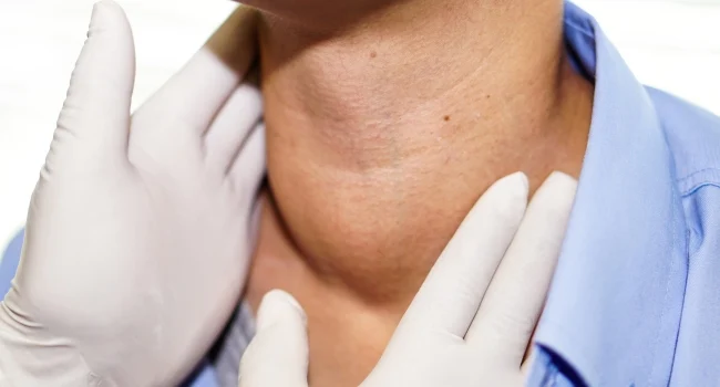 tumor Otorrinolaringología en Zacatecas